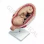 Fetus, 7. Monat, normale Position L10/8