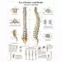 Lehrtafel - Die menschliche Wirbelsäule - Anatomie und Pathologie VR2152L