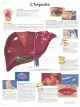 Anatomische Bord : Hepatitis VR2435L