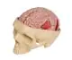 Gehirnerkrankungen Modell Erler Zimmer
