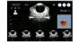 Blasenscanner / Tragbarer Blasenscanner Peaksonic BladderView M4