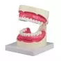 Zahnpflegemodell 1,5- fache Größe Erler Zimmer