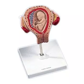 Embryo 3. Monat L10/3