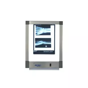 Single-Panel Standard X-Ray-Viewer mit Schalter, 54W