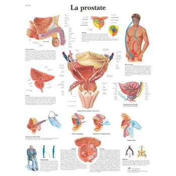 Die anatomische Bord : Prostata VR2528UU 