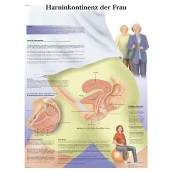 Anatomische Bord : Harninkontinenz bei der Frau VR2542L