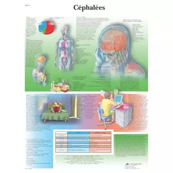 Anatomische Bord : Kopfschmerzen VR2714L