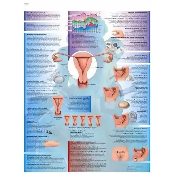 Lehrtafel - Empfängnisverhütung VR2591L