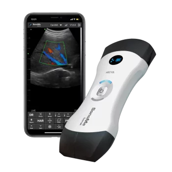 Das vernetzte, ultraportable Ultraschallgerät Bionet SonoMe