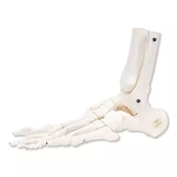 Skelett des Fußes mit Schien-und Waden Stumpf (Wadenbein), elastische Lagerung, CTE links A31/1L