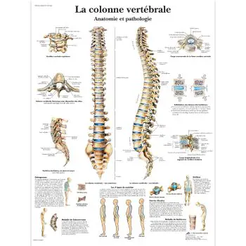 Lehrtafel - Die menschliche Wirbelsäule - Anatomie und Pathologie VR2152L