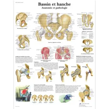 Lehrtafel - Becken und Hüfte - Anatomie und Pathologie VR2172L