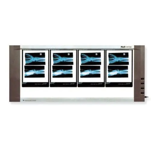 Four panel Röntgenfilmbetrachter (90W)