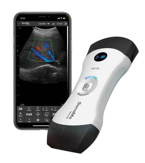 Das vernetzte, ultraportable Ultraschallgerät Bionet SonoMe