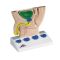 Prostata-Modell (schematisch) K40