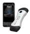 Das vernetzte, ultraportable Ultraschallgerät Bionet SonoMe