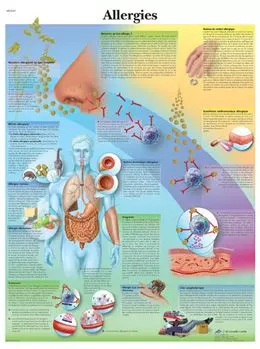 Anatomische Bord : Allergien VR2660L