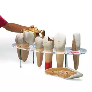 Zahnersatz-Modell, 7-teilig, 10-fache Größe - Englisch W42517