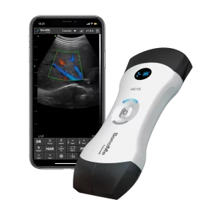 Das vernetzte, ultraportable Ultraschallgerät Bionet SonoMe