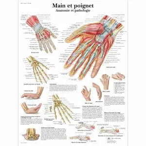 Lehrtafel - Hand und Handgelenk - Anatomie und Pathologie VR2171L