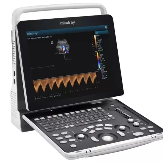 Tragbares Mindray Z50 Ultraschallgerät