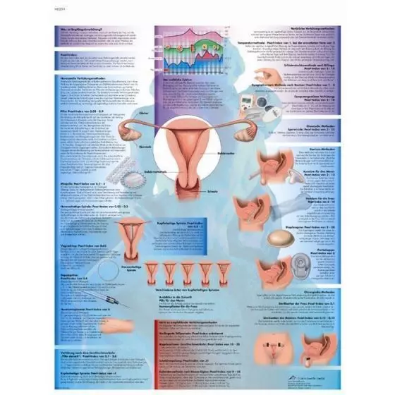 Lehrtafel - Empfängnisverhütung VR2591L