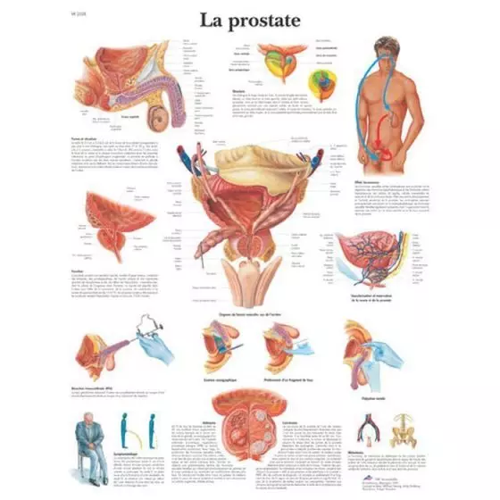  3B Scientific Lehrtafel - Prostata VR2528L