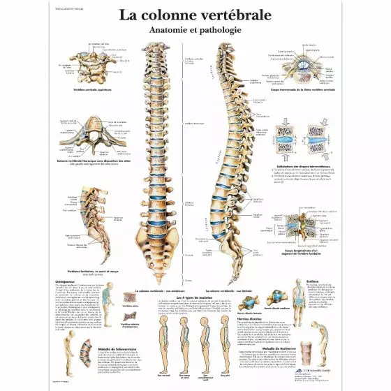 Lehrtafel - Die menschliche Wirbelsäule - Anatomie und Pathologie VR2152L