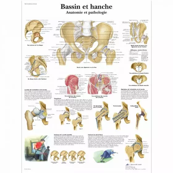 Lehrtafel - Becken und Hüfte - Anatomie und Pathologie VR2172L