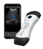 Das vernetzte, ultraportable Ultraschallgerät Bionet SonoMe